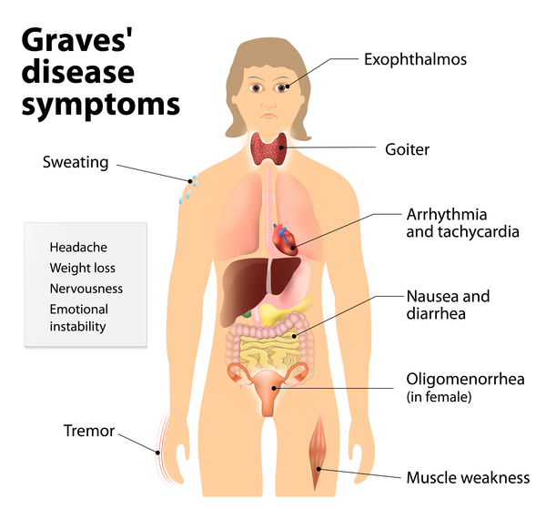 Graves Disease Symptoms OneGRAVESvoice